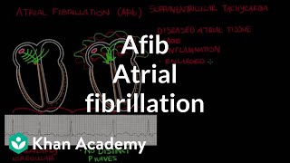 Atrial fibrillation Afib  Circulatory System and Disease  NCLEXRN  Khan Academy [upl. by Rysler]