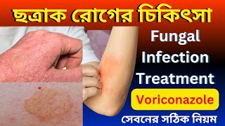 Fungal infection Treatment Bangla  Voriconazole Votab 200 সেবনের সঠিক নিয়ম [upl. by Einnad81]