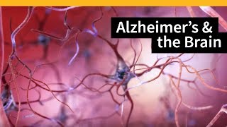 How Alzheimers Changes the Brain [upl. by Hahnke162]