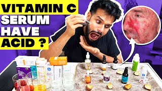 Testing The Best Vitamin C Serum For Indian Skin Shocking Result  BeYourBest Skincare San Kalra​ [upl. by Imena259]