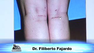 DR FILIBERTO FAJARDO NUÑEZ IMPLANTES DE PANTORRILLA [upl. by Chloris]