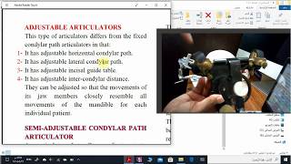 semiadjustable articulator 1 [upl. by Cyprian]