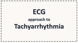 ECG Approach to Tachyarrhythmia SVT PSVT Atrial Fibrillation Ventricular Tachycardia [upl. by Sanoy677]