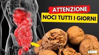 Dibattito chiuso le NOCI sono la miglior frutta secca al mondo [upl. by Irb974]