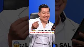 😱¡¿LIMÓN con SAL PARA la DERMATITIS 😨 [upl. by Dane417]