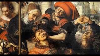 Like a Hole in the Head A History of Trepanning [upl. by Spiers990]