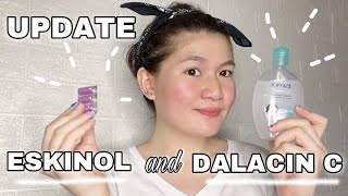 Inexpensive Acne Solution – ESKINOL and DALACIN C UPDATE  EY BELZY [upl. by Husch]