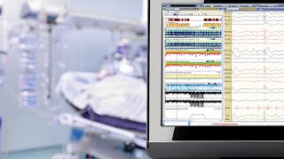 I had to take a Polysomnography test [upl. by Eamanna]