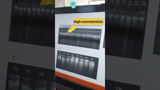 DNA Gel electrophoresis interpretation results youtubeshorts shorts analysis [upl. by Brynna987]