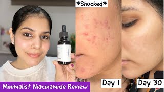 How I Cleared My Acne Within 30 Days  Minimalist 10 Niacinamide  Zinc Review [upl. by Eilla]