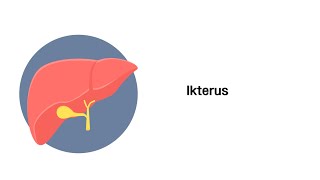 Gelbsucht Ikterus  Erkrankungen von Leber Gallenwege und Pankreas [upl. by Lucila]