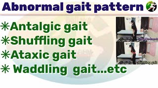 Abnormal gait pattern scissors gait  Antalgic gait  shuffling gait  Ataxic gait pattern [upl. by Anivla948]