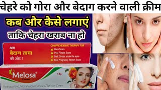 Melosa Cream Review in Hindi  चेहरे को गोरा बनाने वाली क्रीम  Melosa Cream  Face whitening cream [upl. by Roshan]