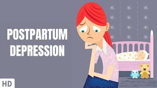 Postpartum Depression Part2 [upl. by Ahseniuq]