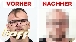 Haarausfall mit 31 Wie kann man Mike helfen  SOS Einsatz der BeautyRetter  taff [upl. by Kcirdet46]