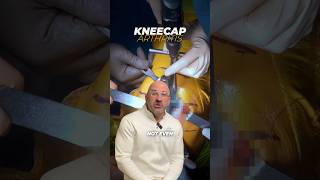 Anterior Knee Pain  What Does It Mean shorts [upl. by Bolton321]