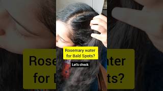 30 Days Rosemary Water Challenge tamil 30daychallenge hairgoals haircare [upl. by Nelram280]