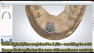 Custom implant abutment design and milling [upl. by Ennail955]