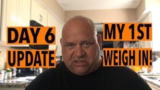 1st Weigh In Day 6 Post Op Update After Gastric Sleeve Surgery in Mexico [upl. by Chemosh]