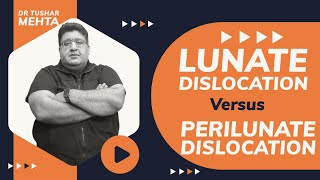 Lunate VS Perilunate Dislocation  DrTusharMehta inicet fmge mbbs neetpg [upl. by Almena959]