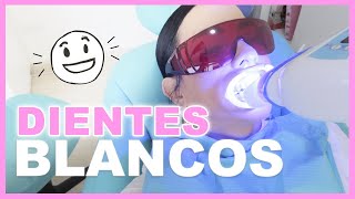 BLANQUEAMIENTO DENTAL LÁSER ¿DOLIÓ  PINK CHICK [upl. by Idid]