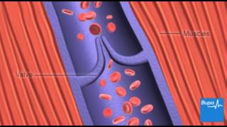 How deep vein thrombosis DVT forms  Bupa Health [upl. by Attevad]