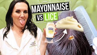 Removing LICE with MAYONNAISE Watch this before you try [upl. by Walrath44]