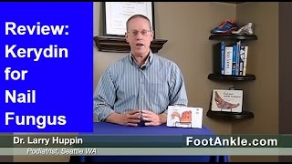 Review of Kerydin for Treatment of Toenail Fungus by Seattle Podiatrist Dr Larry Huppin [upl. by Ayamat]