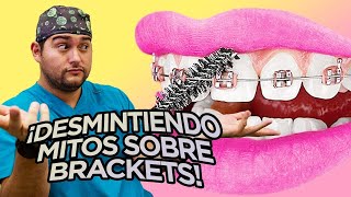 ¿HASTA QUE EDAD SE PUEDEN PONER BRACKETS ¡14 MITOS DESMENTIDOS DE LA ORTODONCIA en tus DIENTES [upl. by Jarid352]