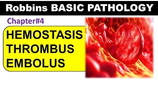 Chp4 Part2 Robbins Basic Patho  Hemostasis  Thrombus  Embolism  General Pathology [upl. by Hillegass]