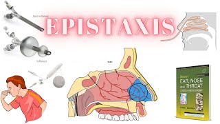 EPISTAXIS DEMYSTIFIED KEY INSIGHTS ON TYPES AND MANAGEMENT dhingra otorhinolaryngology nosebleed [upl. by Fredenburg139]