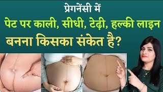 नाभि पर बनी लाइन से जाने गर्भ में लड़का है या लड़की l Nabhi line l Linea nigra gender prediction [upl. by Nylyahs865]