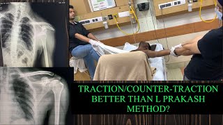 TractionCountertraction better than the L Prakash External rotation method [upl. by Letsyrc]