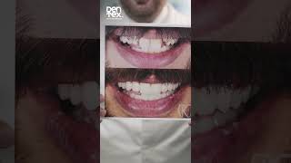 dentex اكسبلور dentist من هو الدكتور خليل [upl. by Rheba]