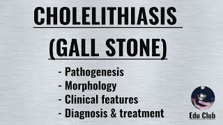 Cholelithiasis Gall Stone  Cholesterol stone  Pigment stone [upl. by Enelym]