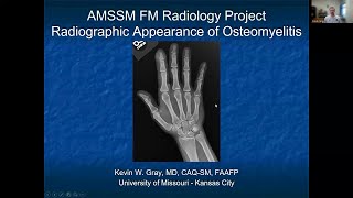 Osteomyelitis  MSK Radiology XRay Educational Modules for Primary Care Residents [upl. by Begga]