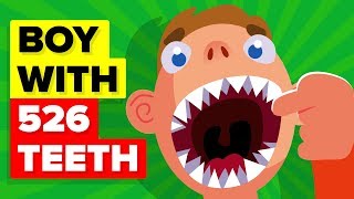 Real Life Shark Boy With 526 Teeth True Story [upl. by Ecyle857]