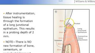 Nonsurgical Periodontal Therapy NSPT  Perio Ch 24 Lect I [upl. by Strander]