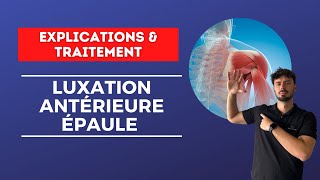 La luxation d’épaule  Si difficile à rééduquer   Explications et traitement [upl. by Ellegna]