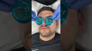 Relaxing facial ice globes  Dr Medispa [upl. by Sadonia986]