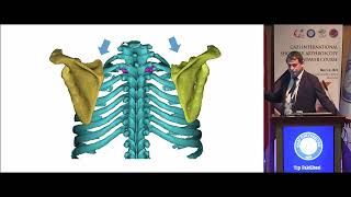 Scapulothoracic Problems [upl. by Uni]