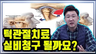 턱관절 치료 실비 청구 가능할까요 [upl. by Einyaj]