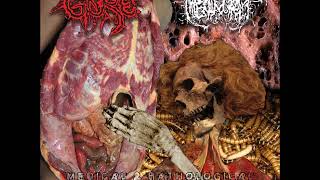 Gore x Hipermenorrea  Medical amp Pathological Splatter Lacerations Split EP [upl. by Esdnyl]