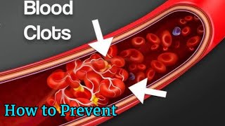 3 Foods That may Prevent Blood Clots [upl. by Quickel460]