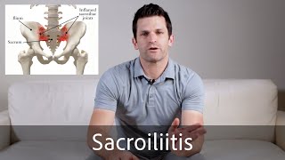 Sacroiliitis [upl. by Letsyrk]