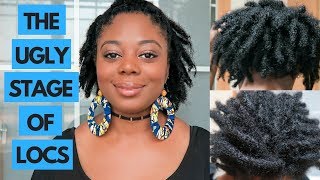 THE UGLY STAGE OF LOCS  TIPS FOR THE BEGINNING STAGES [upl. by Orpah165]