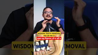 When to remove wisdom tooth suratdentist dentist smiledentist [upl. by Aipotu813]