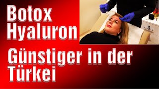 Hyaluron Botox Erfahrung Istanbul Medical Exclusive Türkei Behandlung Zornesfalte Filler [upl. by Vergne]