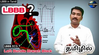 Left Bundle Branch Block in Tamil  LBBB in tamil  RBBB  PS tamil [upl. by Noevad27]