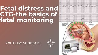 Monitoring for fetal distress CTG monitoring How do we decide action based on CTG Dr Sridhar K [upl. by Heywood720]